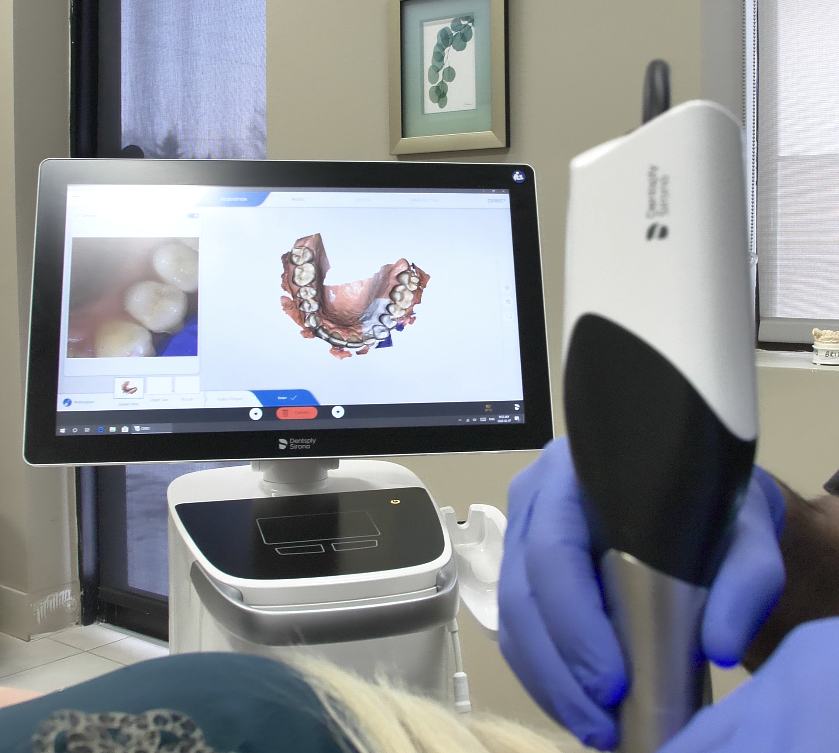 cerec-1